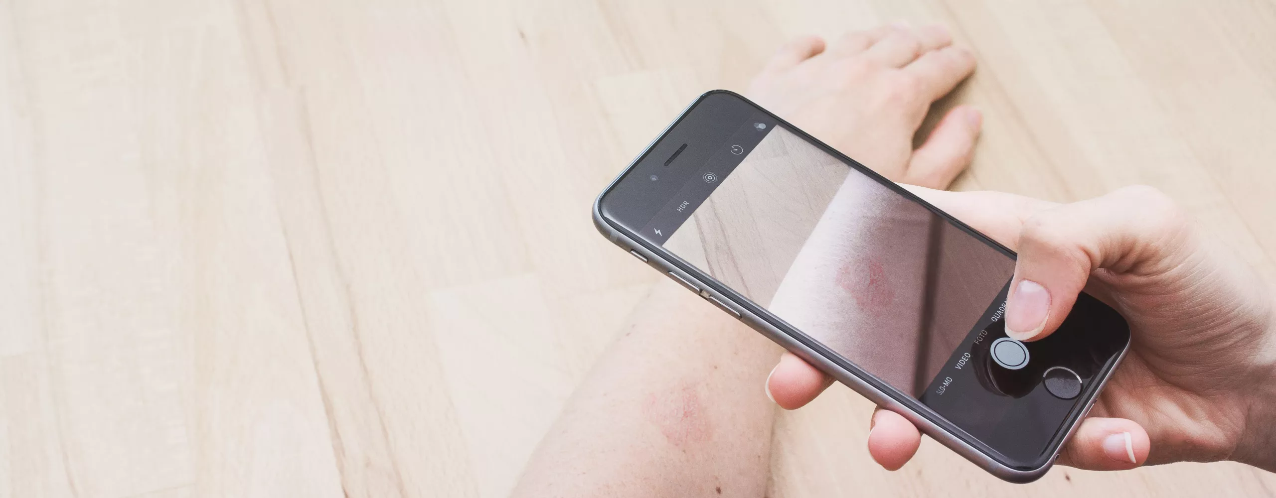 Frau fotografiert ihren Arm für eine Hautuntersuchung